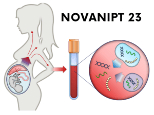 Xét nghiệm NIPT - NovaNIPT 23 tại NovaMed