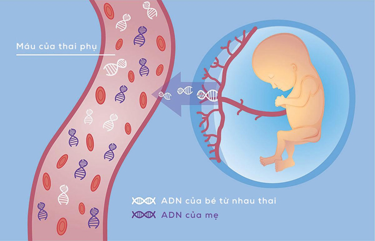 Cơ chế xét nghiệm NIPT